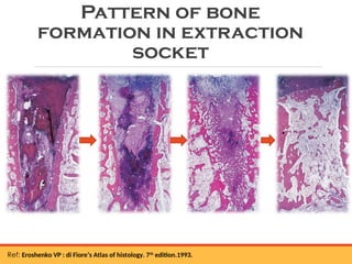 residual ridge resorption seminar final [Autosaved] latest.ppt