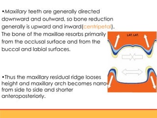 residual ridge resorption seminar final [Autosaved] latest.ppt