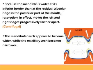 residual ridge resorption seminar final [Autosaved] latest.ppt