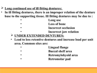 residual ridge resorption seminar final [Autosaved] latest.ppt
