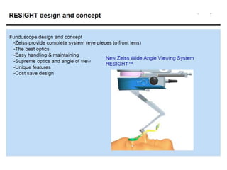Resight Kit Resight VIUALIZATION SYSTEM FOR RETINAL SURGERY-AJAY DUDANI | PPTX