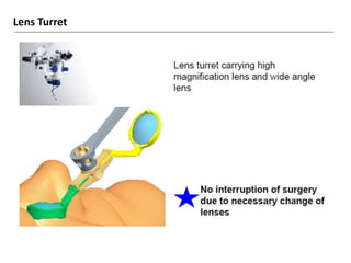 Resight VIUALIZATION SYSTEM FOR RETINAL SURGERY-AJAY DUDANI | PPTX