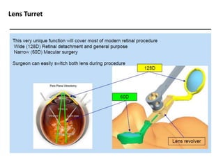 Resight Kit Resight VIUALIZATION SYSTEM FOR RETINAL SURGERY-AJAY DUDANI | PPTX