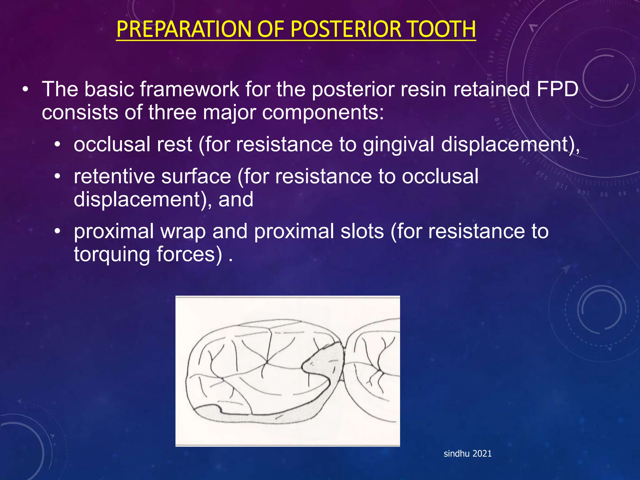PREPARATION OF POSTERIOR TOOTH
• The basic framework for the posterior resin retained FPD
consists of three major components:
• occlusal rest (for resistance to gingival displacement),
• retentive surface (for resistance to occlusal
displacement), and
• proximal wrap and proximal slots (for resistance to
torquing forces) .
sindhu 2021
 