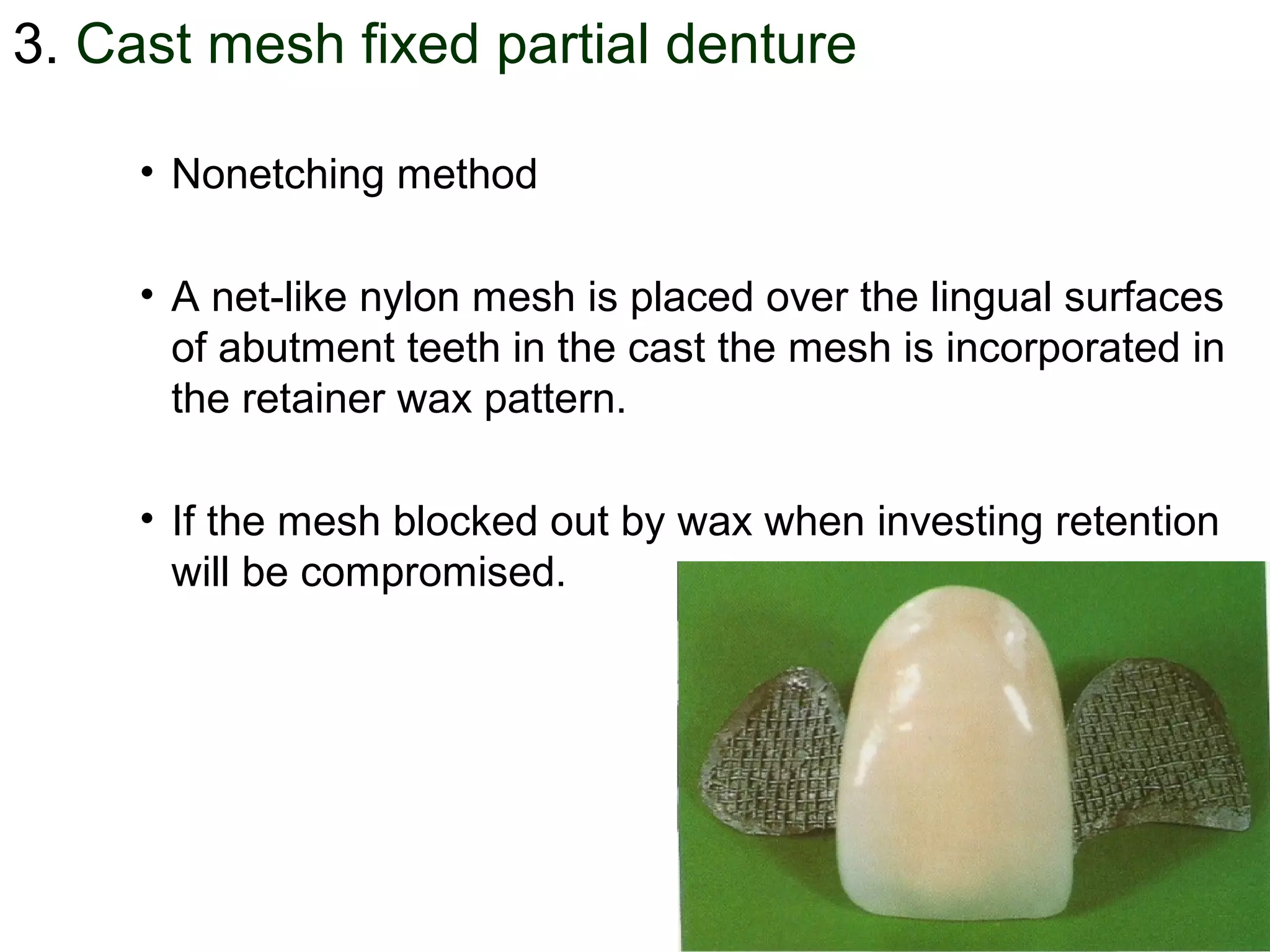 3. Cast mesh fixed partial denture
• Nonetching method
• A net-like nylon mesh is placed over the lingual surfaces
of abutment teeth in the cast the mesh is incorporated in
the retainer wax pattern.
• If the mesh blocked out by wax when investing retention
will be compromised.
 