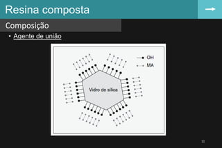 • Agente de união
Resina composta
Composição
11
 