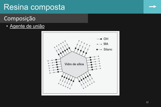 • Agente de união
Resina composta
Composição
12
 