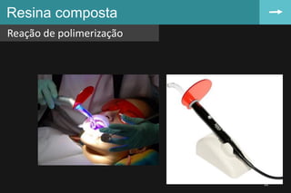 Resina composta
Reação de polimerização
32
 