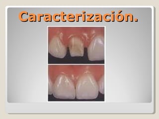 Caracterización.   