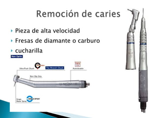 Pieza de alta velocidad Fresas de diamante o carburo cucharilla 