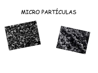 MICRO PARTÍCULAS
 