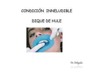 CONDICIÓN INNELUDIBLE
DIQUE DE HULE
Dr. Delgado.
 