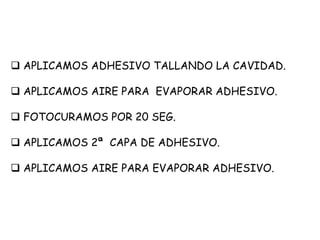  APLICAMOS ADHESIVO TALLANDO LA CAVIDAD.
 APLICAMOS AIRE PARA EVAPORAR ADHESIVO.
 FOTOCURAMOS POR 20 SEG.
 APLICAMOS 2ª CAPA DE ADHESIVO.
 APLICAMOS AIRE PARA EVAPORAR ADHESIVO.
 
