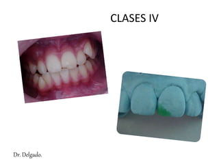 CLASES IV
Dr. Delgado.
 