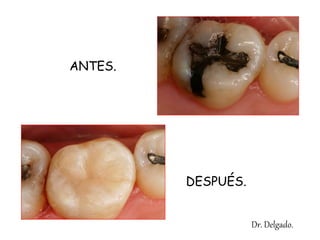 ANTES.
DESPUÉS.
Dr. Delgado.
 
