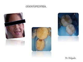 Dr. Delgado.
ODONTOPEDITRÍA.
 