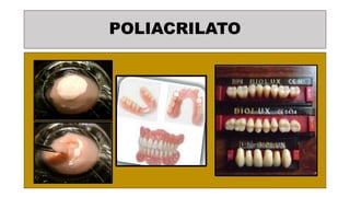 POLIACRILATO
 