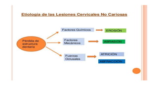 RESINAS_COMPUESTAS[1].pdffwseeeeeeeeeeeeeeeeeee