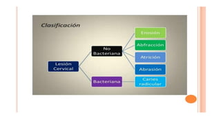 RESINAS_COMPUESTAS[1].pdffwseeeeeeeeeeeeeeeeeee