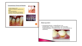 RESINAS_COMPUESTAS[1].pdffwseeeeeeeeeeeeeeeeeee