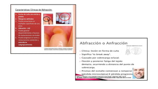 RESINAS_COMPUESTAS[1].pdffwseeeeeeeeeeeeeeeeeee