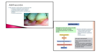 RESINAS_COMPUESTAS[1].pdffwseeeeeeeeeeeeeeeeeee