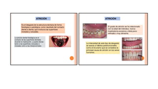 RESINAS_COMPUESTAS[1].pdffwseeeeeeeeeeeeeeeeeee