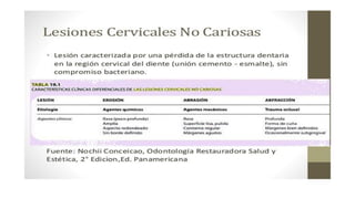 RESINAS_COMPUESTAS[1].pdffwseeeeeeeeeeeeeeeeeee