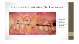 RESINAS_COMPUESTAS[1].pdffwseeeeeeeeeeeeeeeeeee