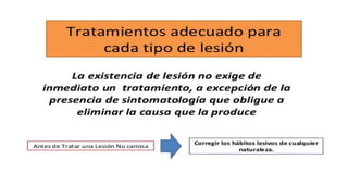 RESINAS_COMPUESTAS[1].pdffwseeeeeeeeeeeeeeeeeee