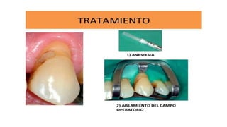 RESINAS_COMPUESTAS[1].pdffwseeeeeeeeeeeeeeeeeee