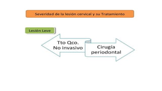 RESINAS_COMPUESTAS[1].pdffwseeeeeeeeeeeeeeeeeee