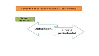 RESINAS_COMPUESTAS[1].pdffwseeeeeeeeeeeeeeeeeee