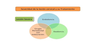 RESINAS_COMPUESTAS[1].pdffwseeeeeeeeeeeeeeeeeee