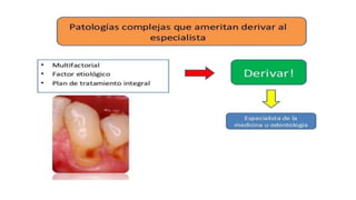 RESINAS_COMPUESTAS[1].pdffwseeeeeeeeeeeeeeeeeee