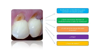 RESINAS_COMPUESTAS[1].pdffwseeeeeeeeeeeeeeeeeee