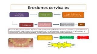 RESINAS_COMPUESTAS[1].pdffwseeeeeeeeeeeeeeeeeee