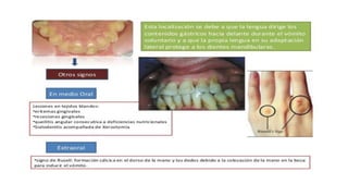 RESINAS_COMPUESTAS[1].pdffwseeeeeeeeeeeeeeeeeee