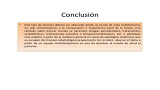 RESINAS_COMPUESTAS[1].pdffwseeeeeeeeeeeeeeeeeee