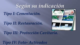 Según su indicación
Tipo I: Cementación.
Tipo II: Restauración.
Tipo III: Protección Cavitaria.
Tipo IV: Foto- Activados
 