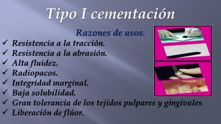 Tipo I cementación
Razones de usos:
✓ Resistencia a la tracción.
✓ Resistencia a la abrasión.
✓ Alta fluidez.
✓ Radiopacos.
✓ Integridad marginal.
✓ Baja solubilidad.
✓ Gran tolerancia de los tejidos pulpares y gingivales
✓ Liberación de flúor.
 