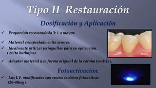 Tipo II Restauración
Dosificación y Aplicación
✓ Proporción recomendada 3: 1 o mayor.
✓ Material encapsulado evita errores.
✓ Idealmente utilizar jeringuillas para su aplicación.
( evita burbujas).
✓ Adaptar material a la forma original de la corona (matriz ).
Fotoactivación:
✓ Los I.V. modificados con resina se deben fotoactivar
(20-40seg ).
 