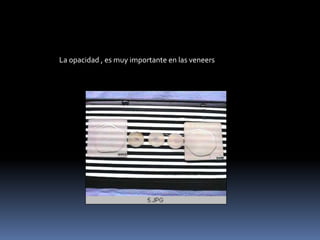 La opacidad , es muy importante en las veneers
 