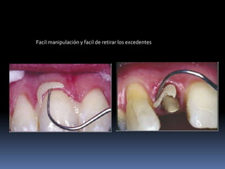 Facil manipulación y facil de retirar los excedentes
 
