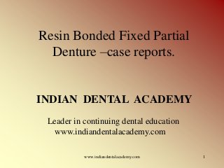 Resin Bonded Fixed Partial
Denture –case reports.

INDIAN DENTAL ACADEMY
Leader in continuing dental education
www.indiandentalacademy.com
www.indiandentalacademy.com

1

 