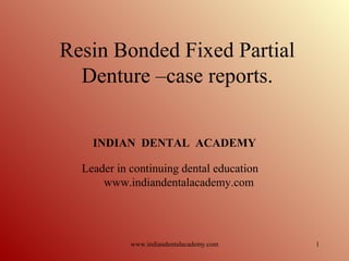 1
Resin Bonded Fixed Partial
Denture –case reports.
INDIAN DENTAL ACADEMY
Leader in continuing dental education
www.indiandentalacademy.com
www.indiandentalacademy.com
 
