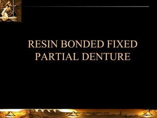 RESIN BONDED FIXED
PARTIAL DENTURE
INDIAN DENTAL ACADEMY
Leader in continuing dental education
www.indiandentalacademy.com
www.indiandentalacademy.com

 