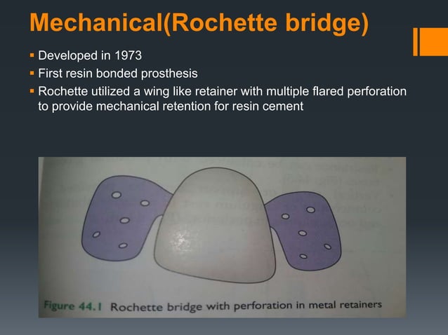 RESIN BONDED FPD.pptx