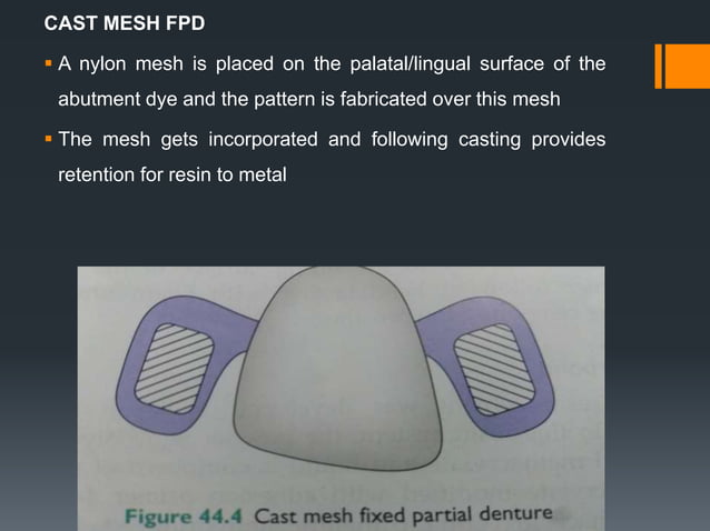 RESIN BONDED FPD.pptx