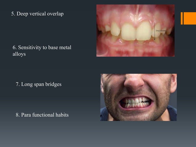 RESIN BONDED FPD.pptx
